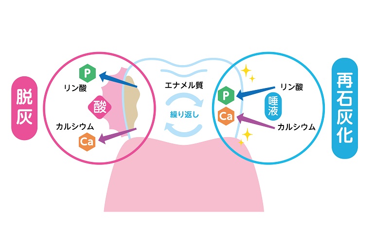 歯の再石灰化とは？