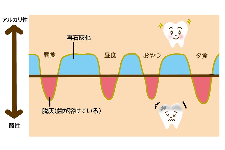 脱灰の時間が長いと虫歯になる