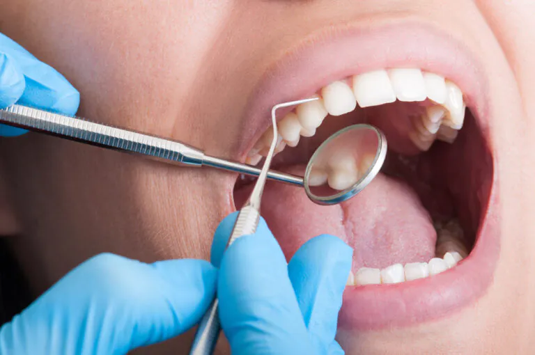 歯科用器具で口内を見る