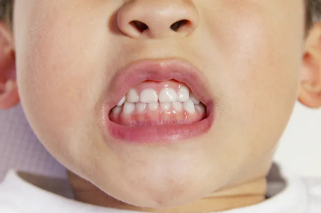 歯を見せる子供