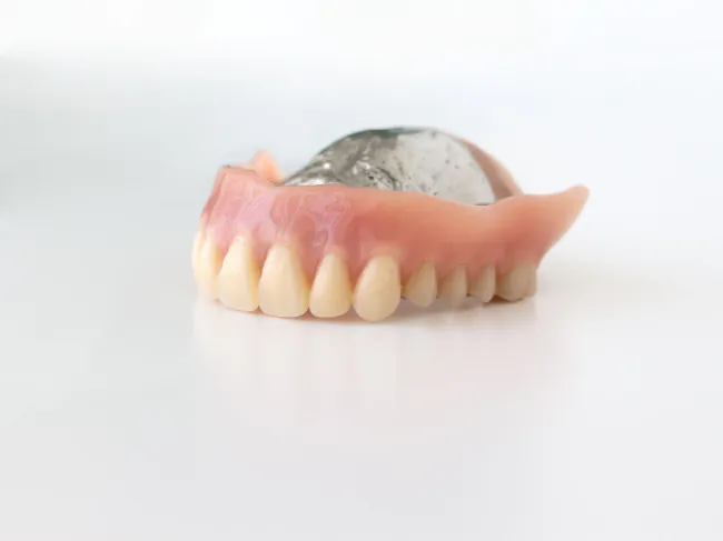 上顎の金属床義歯