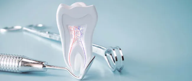 歯の神経と治療器具のイメージ