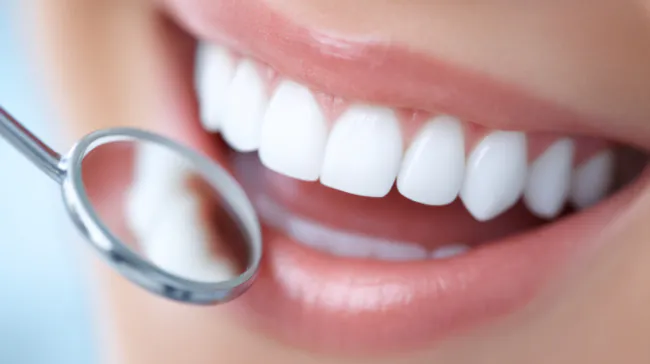 ホワイトニングで白く美しくなった前歯