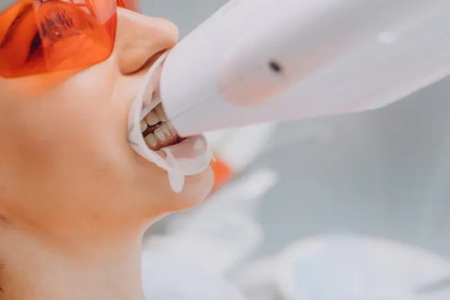 オフィスホワイトニングを受ける女性