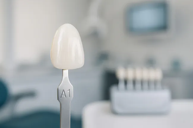 シェードガイドで歯の色を決めるイメージ