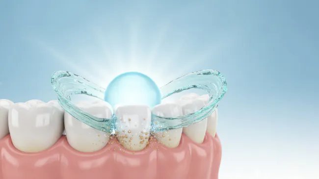 PMTCで歯がきれいになるイメージ