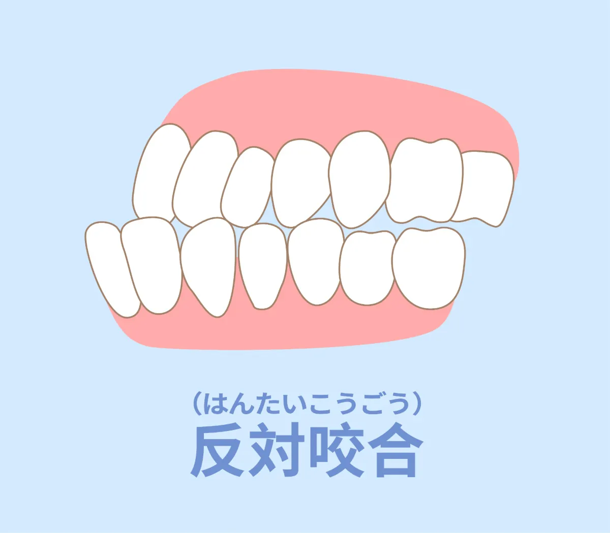 受け口の構造